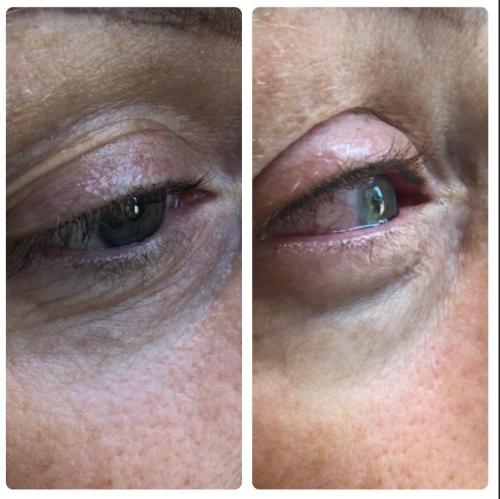 leeds-eyeliner-permanent-makeup-1