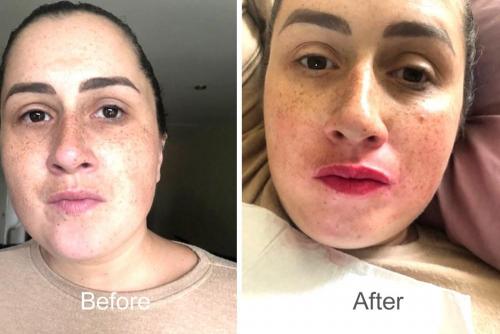 semi-permanent-makeup-lips-enhanced-3